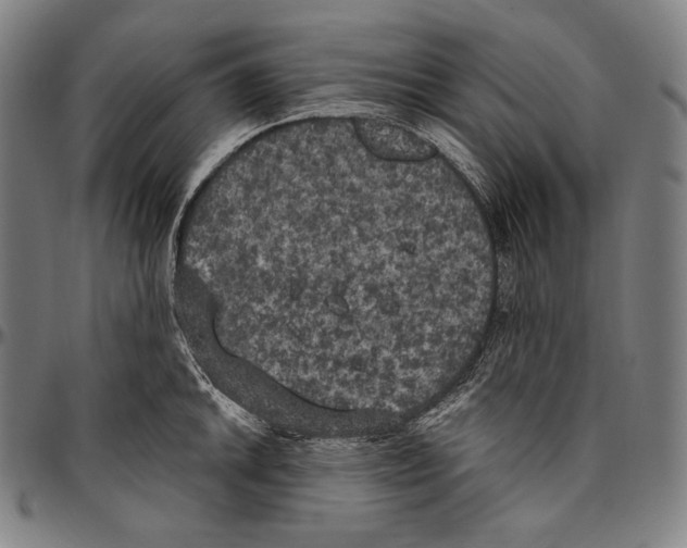 X0000096491046200802211233