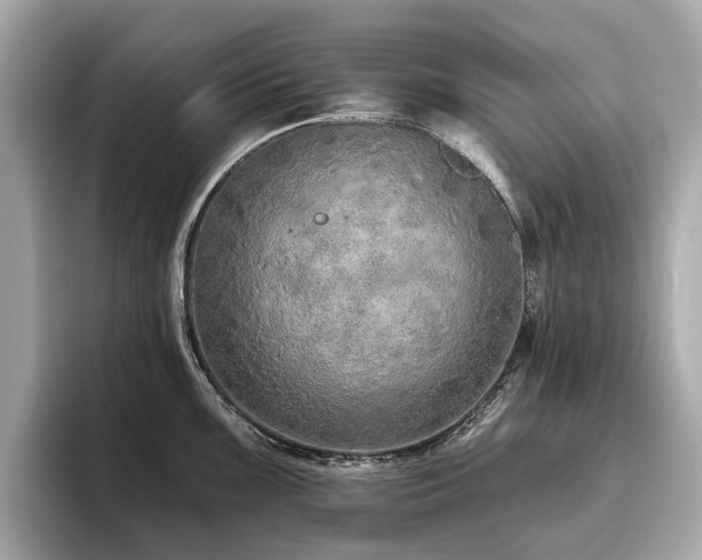 X0000096631099200802051101