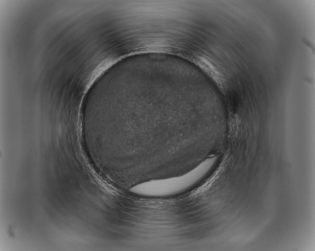 X0000096631077200802191151