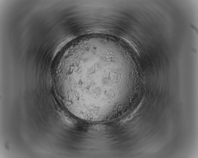 X0000096631117200802191150
