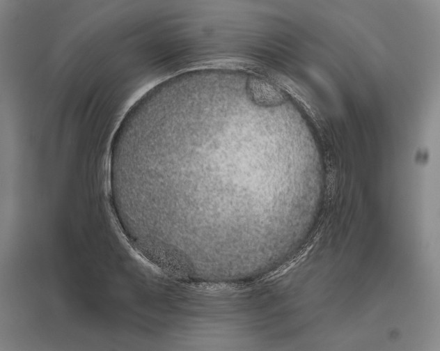 X0000096631079200802261159