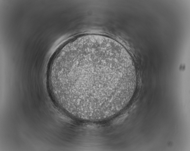 X0000096630199200803041111