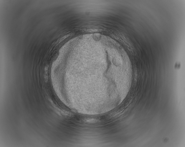 X0000096630360200803041109