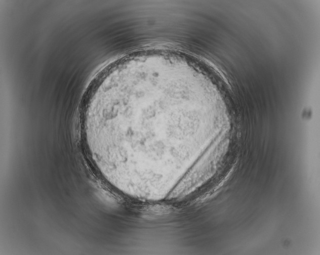 X0000096631117200803041058