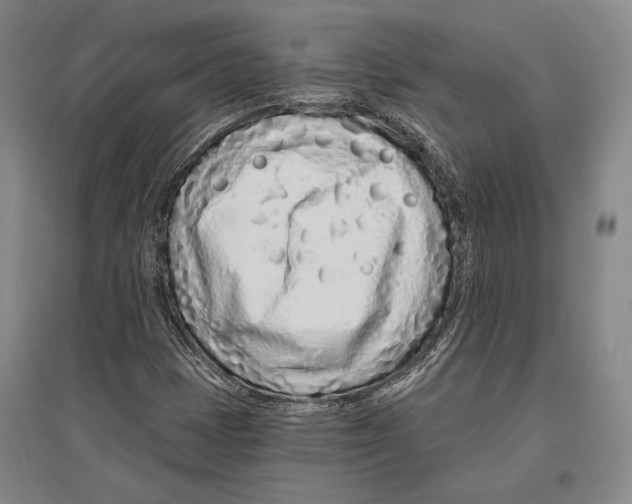 X0000096631401200803041054