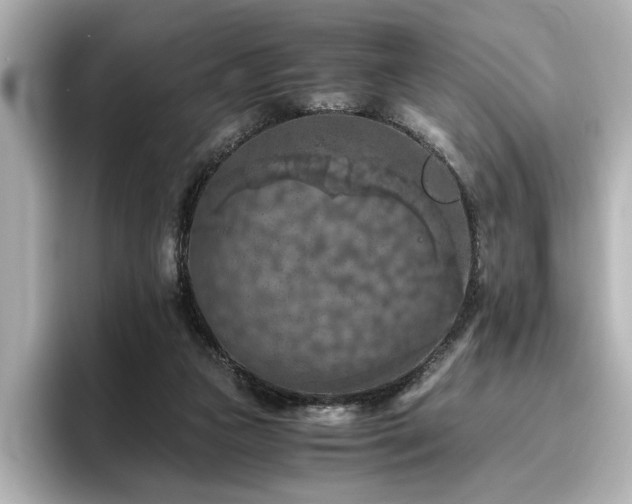 X0000096640161200802051135
