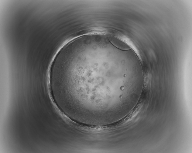 X0000096641099200802051123