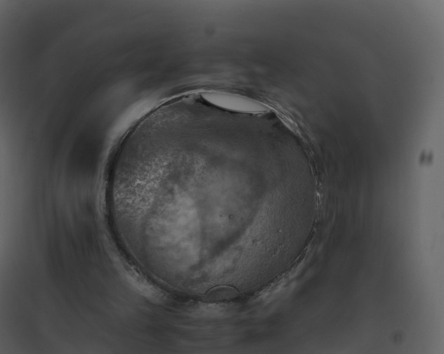 X0000096640149200802121118