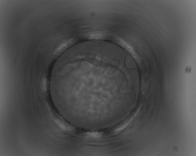X0000096640161200802121118