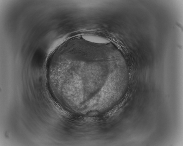 X0000096640149200802191227