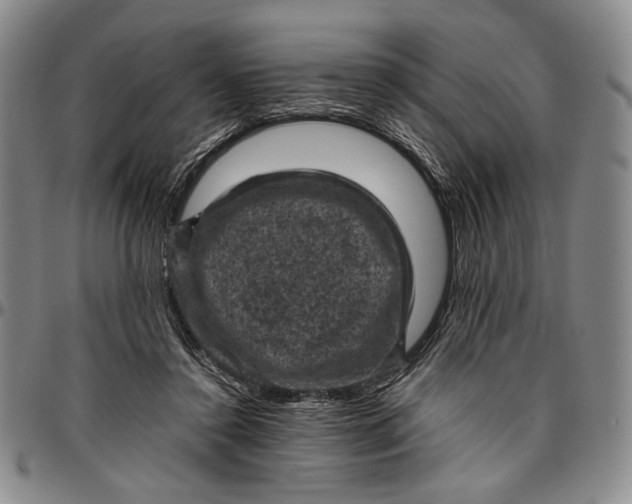 X0000096640356200802191225