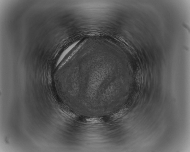 X0000096640516200802191223