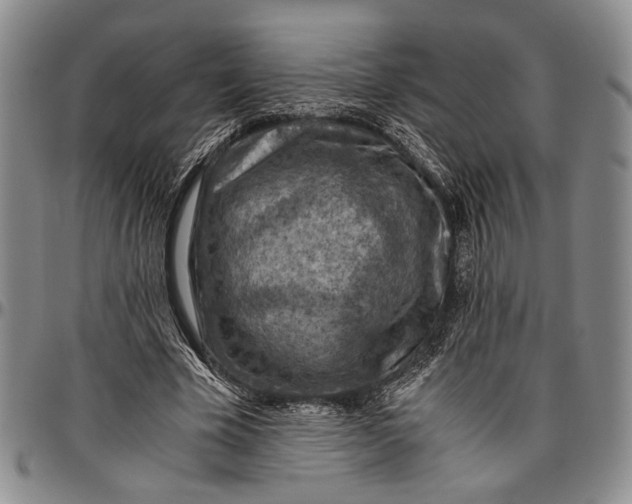 X0000096640585200802191222