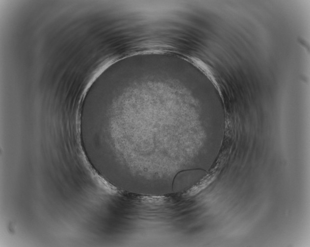 X0000096640859200802191218