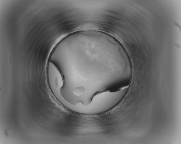 X0000096640864200802191218