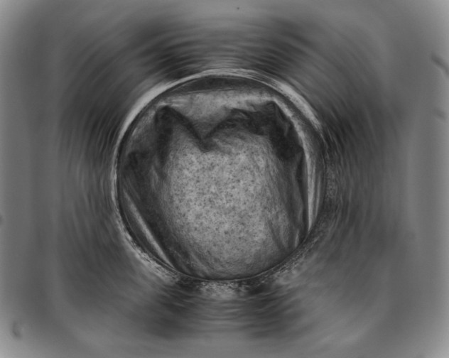 X0000096640955200802191217