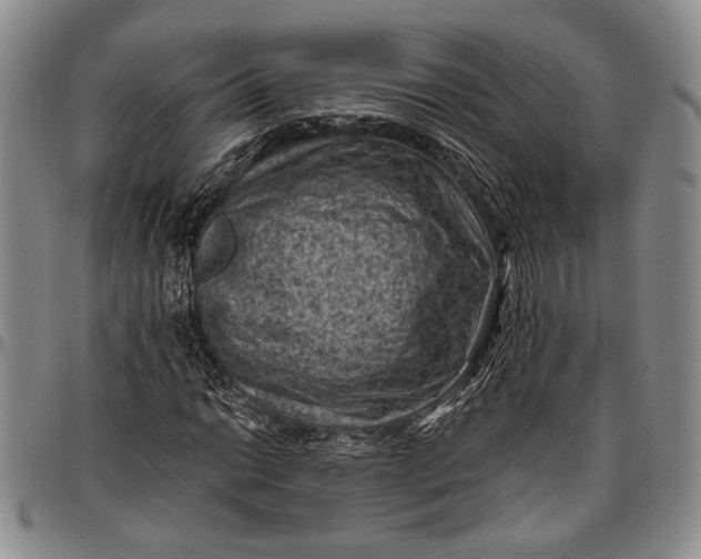 X0000096641014200802191215