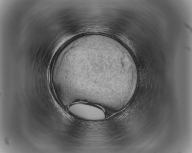 X0000096641032200802191215