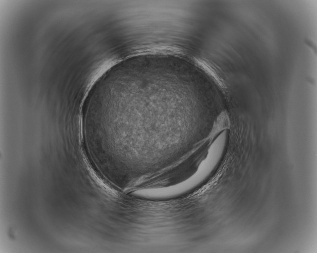 X0000096641079200802191214