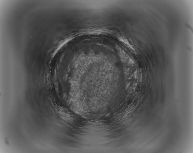 X0000096641256200802191212