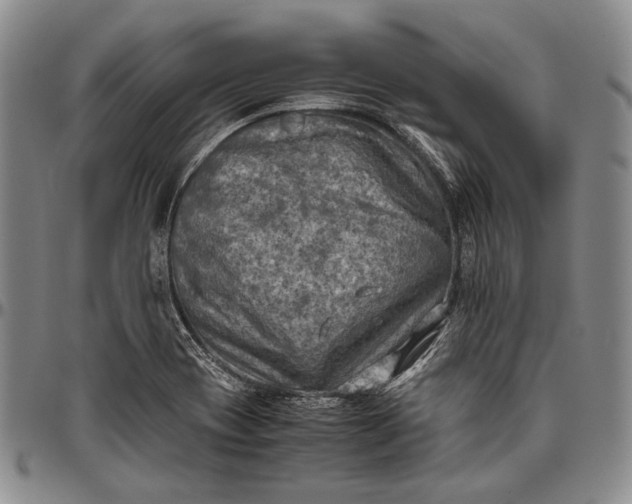 X0000096641417200802191209