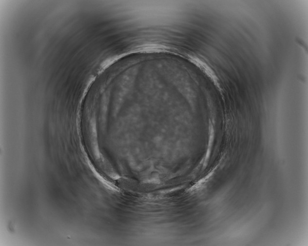 X0000096641429200802191209