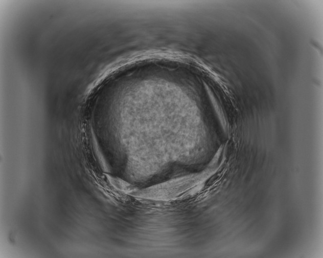 X0000096641496200802191208