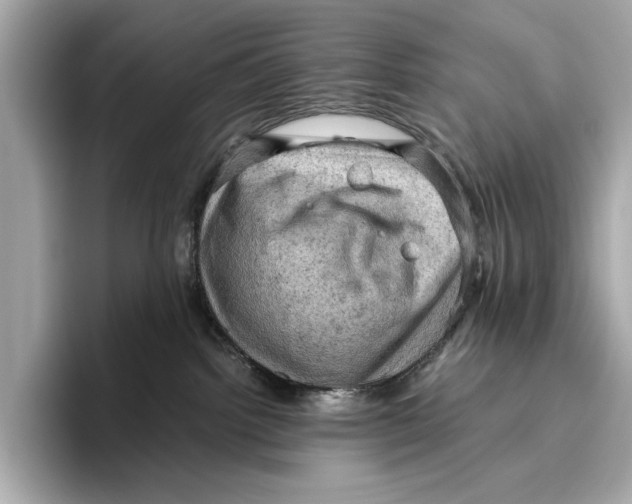 X0000096640092200802261308