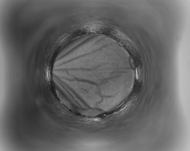 X0000096641155200802261251