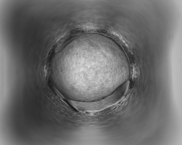 X0000096641157200802261251