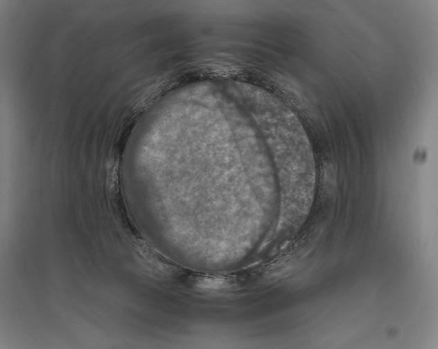 X0000096640177200803041135