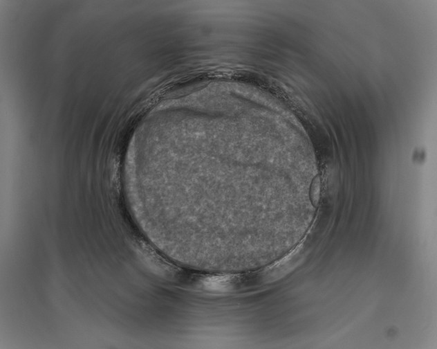 X0000096640178200803041135