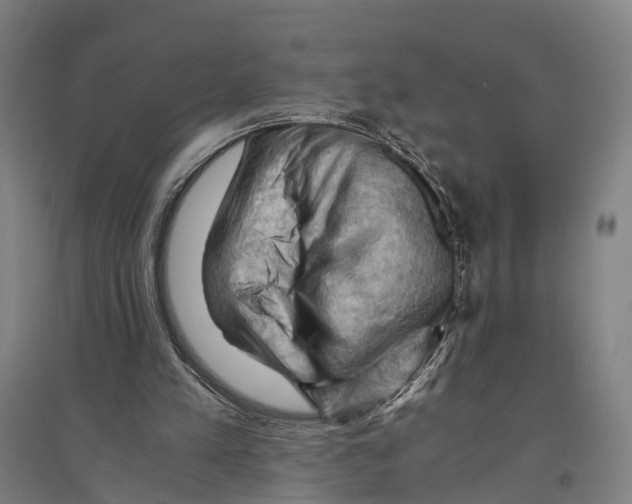 X0000096640197200803041134