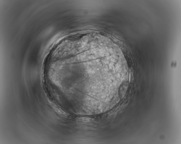 X0000096640339200803041131