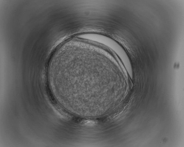 X0000096640352200803041131