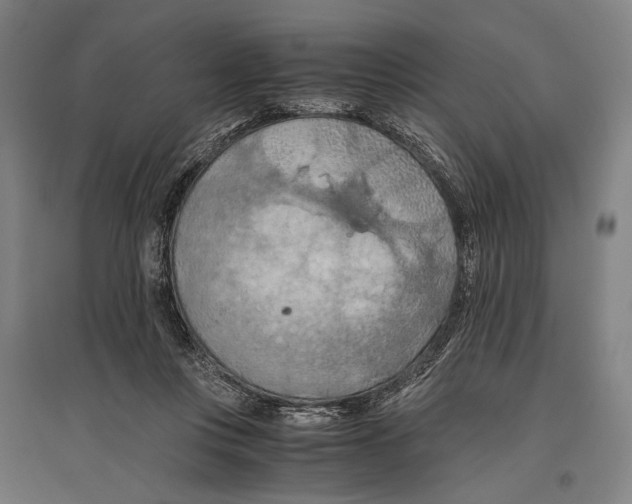 X0000096640359200803041131