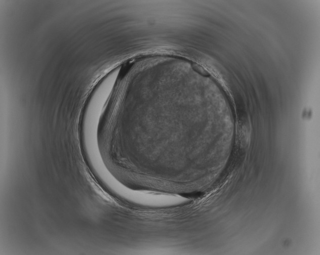 X0000096640389200803041131