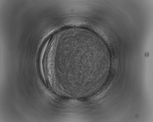 X0000096640399200803041131