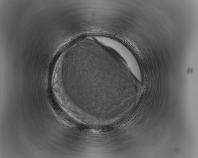 X0000096640496200803041130