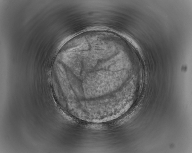 X0000096640953200803041123