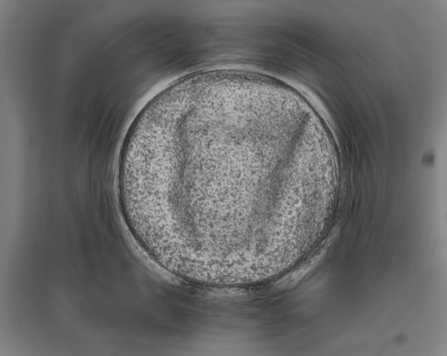 X0000096640957200803041123