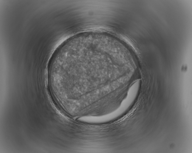 X0000096641079200803041121