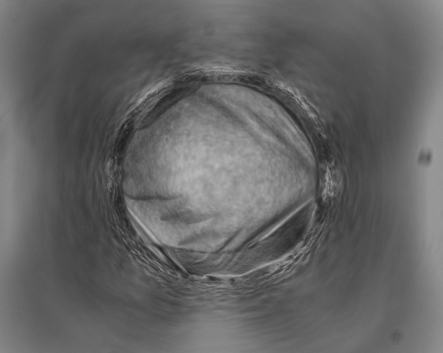 X0000096641157200803041120