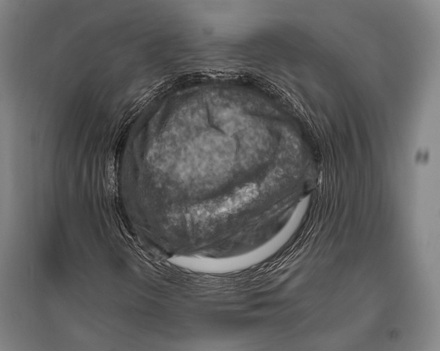 X0000096641298200803041117