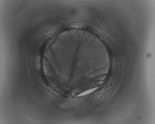 X0000096641394200803041115