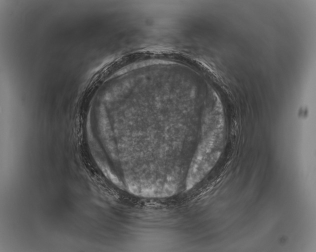 X0000096641398200803041116