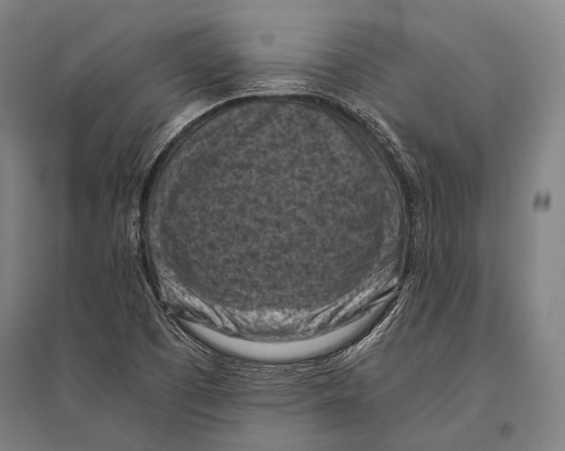 X0000096641457200803041115