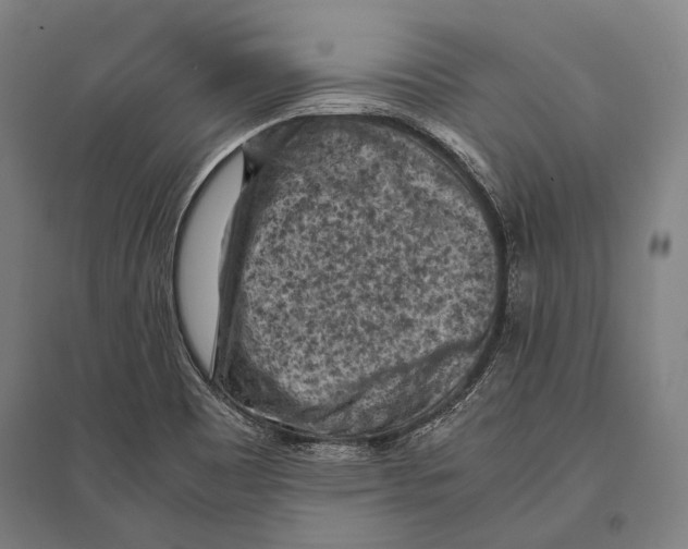 X0000096641465200803041115