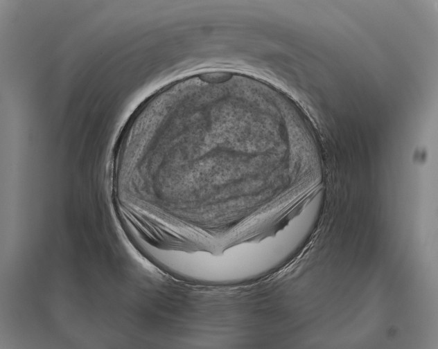 X0000096641519200803041114