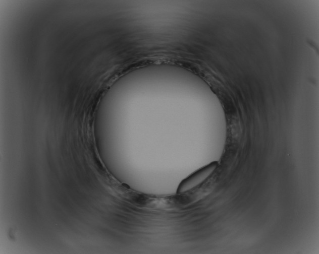 X0000096650611200802050935